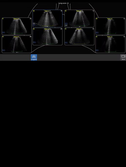 critical-care-lung-diagram-review-cc-st-en