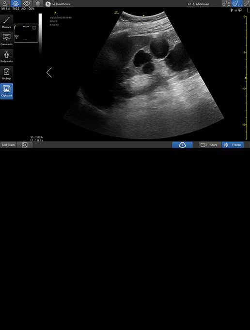 critical-care-simple-screen-st-en