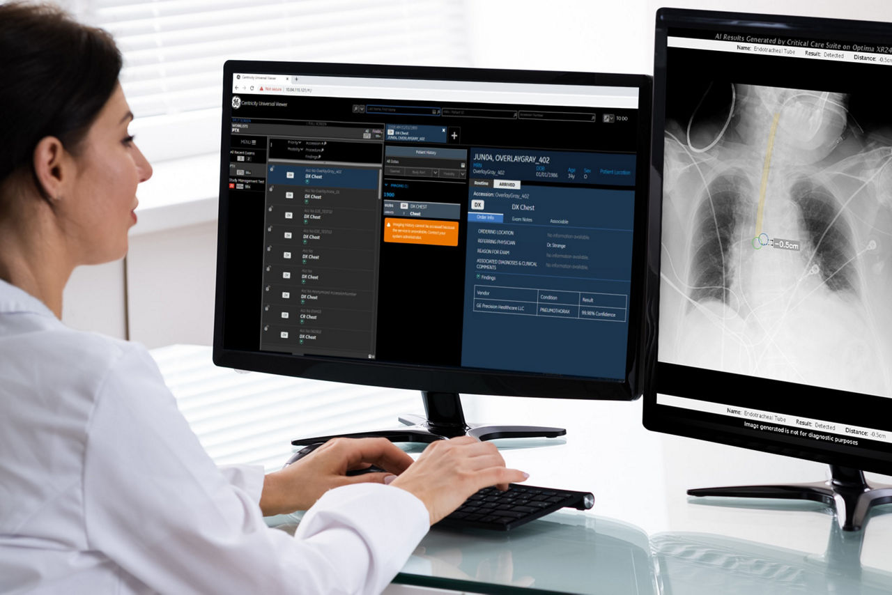 critical-care-suite-software-on-screen-ci-en