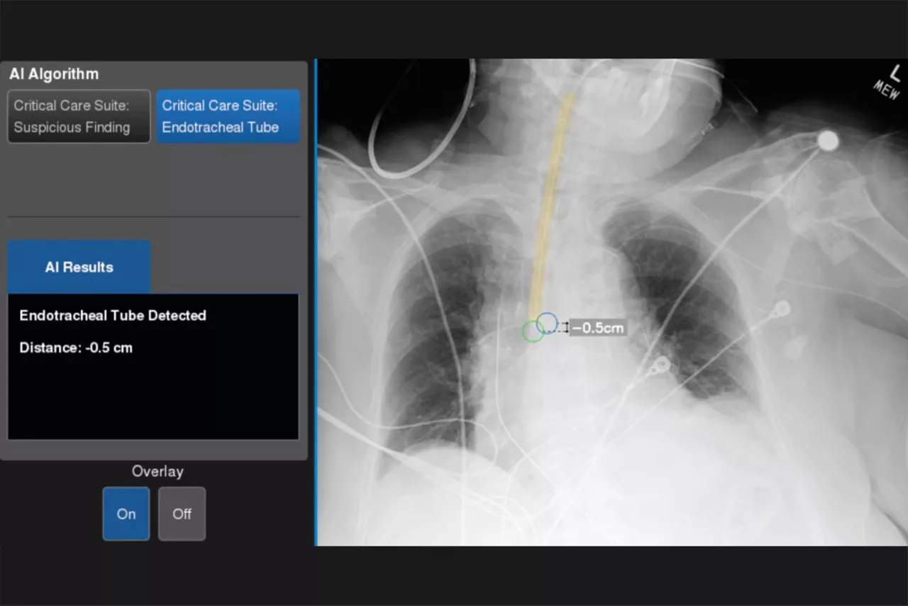 critical-care-suite-tube-positioning-vi-en