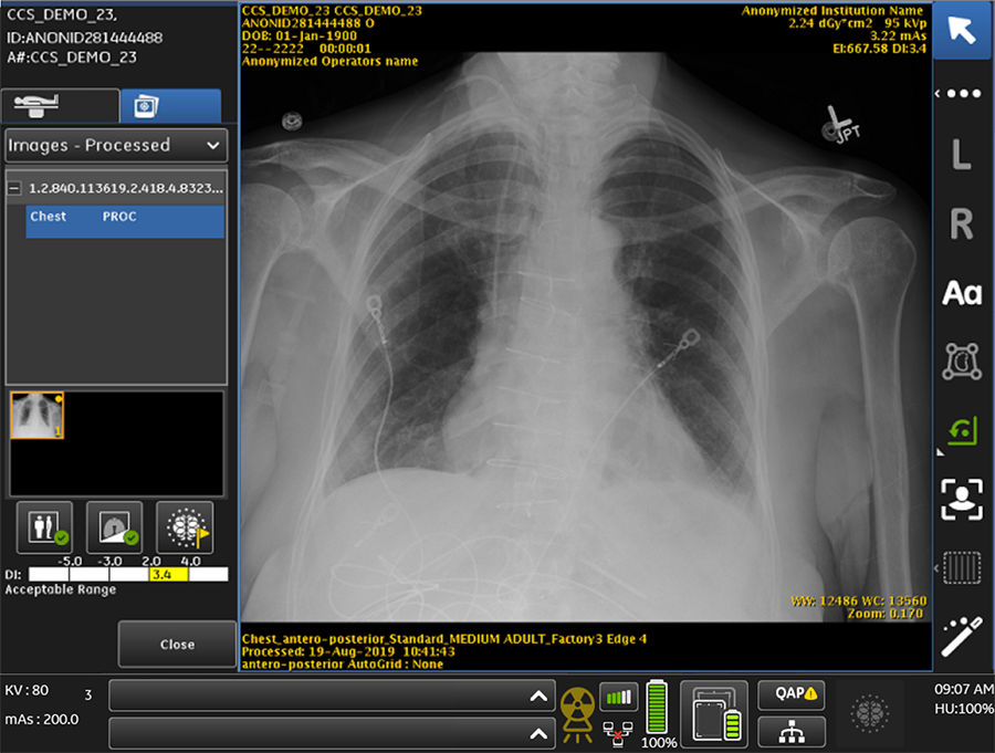 Critical Care Suite_900