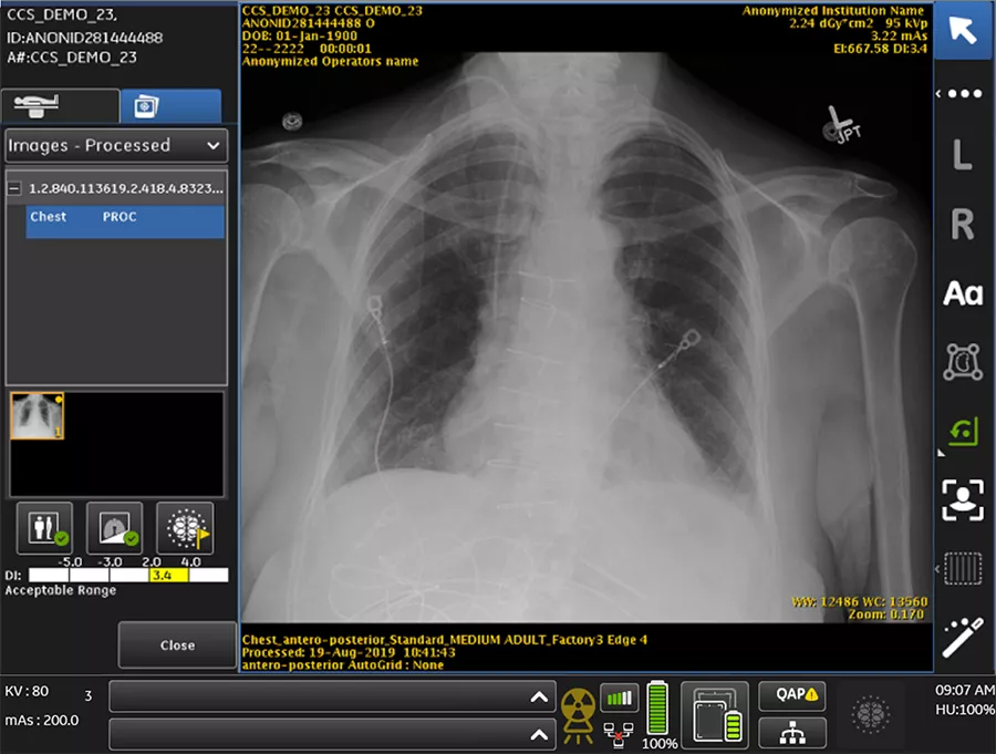 Critical Care Suite_900