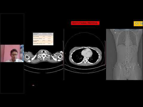 CT MR Evaluation of Trauma