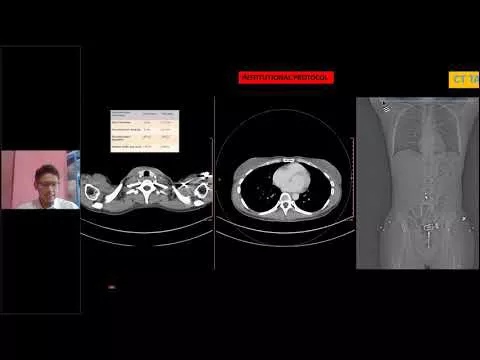 CT MR Evaluation of Trauma