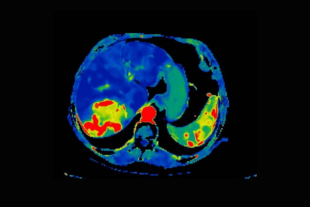 ct-perfusion-image-ci-en