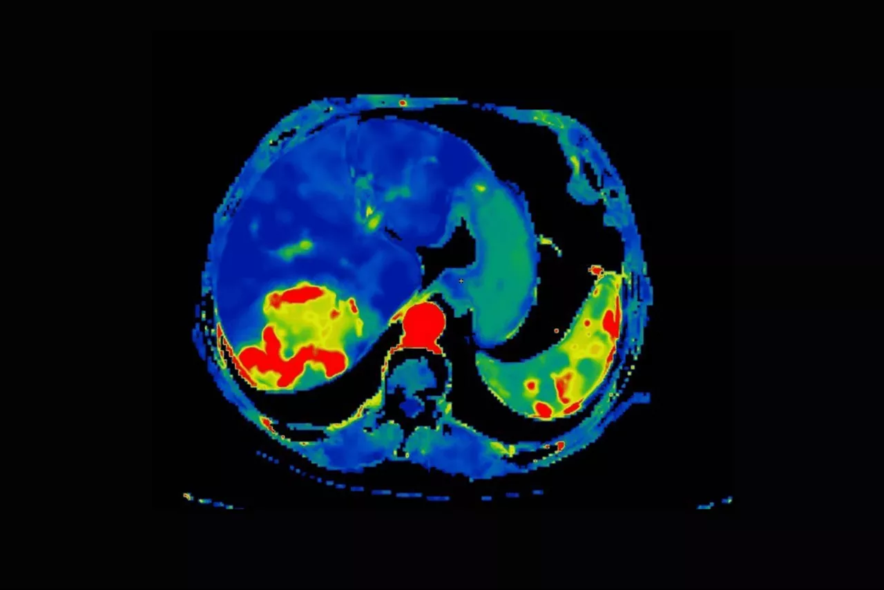ct-perfusion-image-ci-en