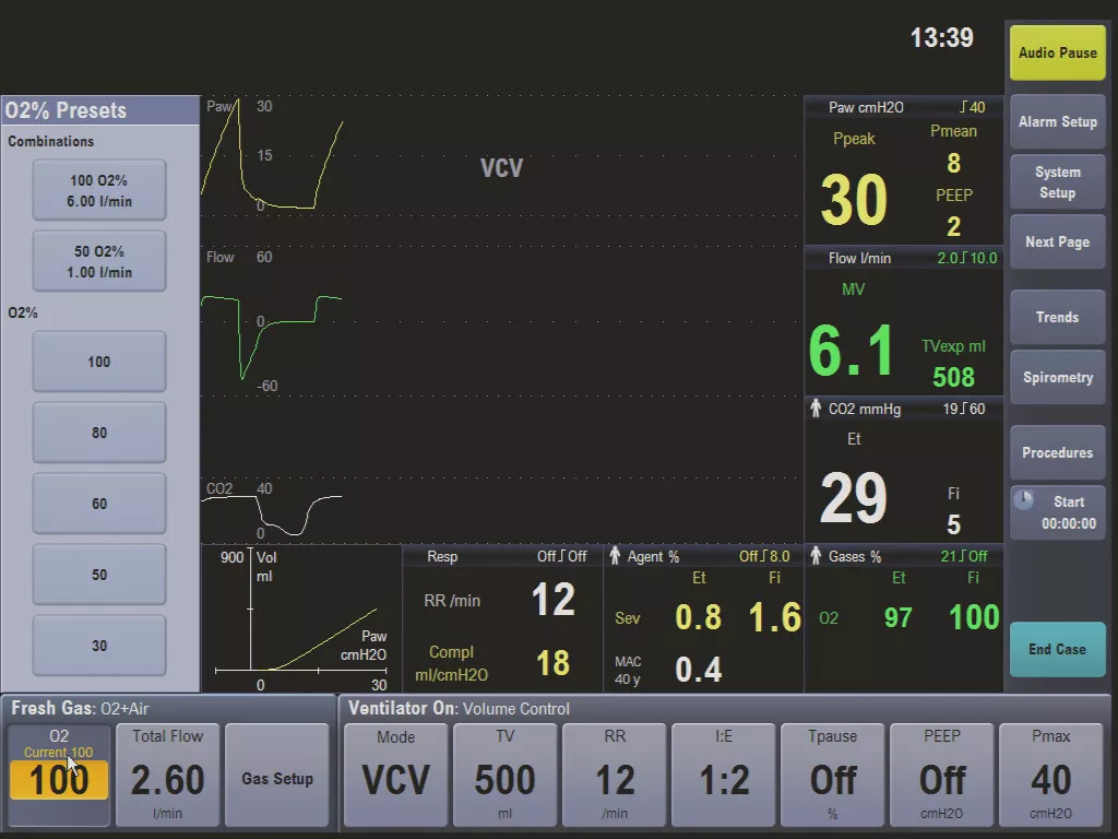 ct-product-categories-anesthesia-delivery-avance cs2-gehc-avance-cs2-technology_screen.bmp