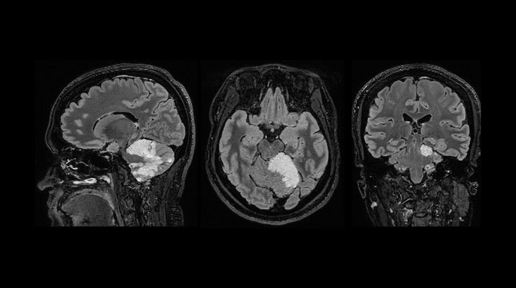 <p>Cube (compatible with AIR™ Recon DL) &amp; Cube Flex</p>
