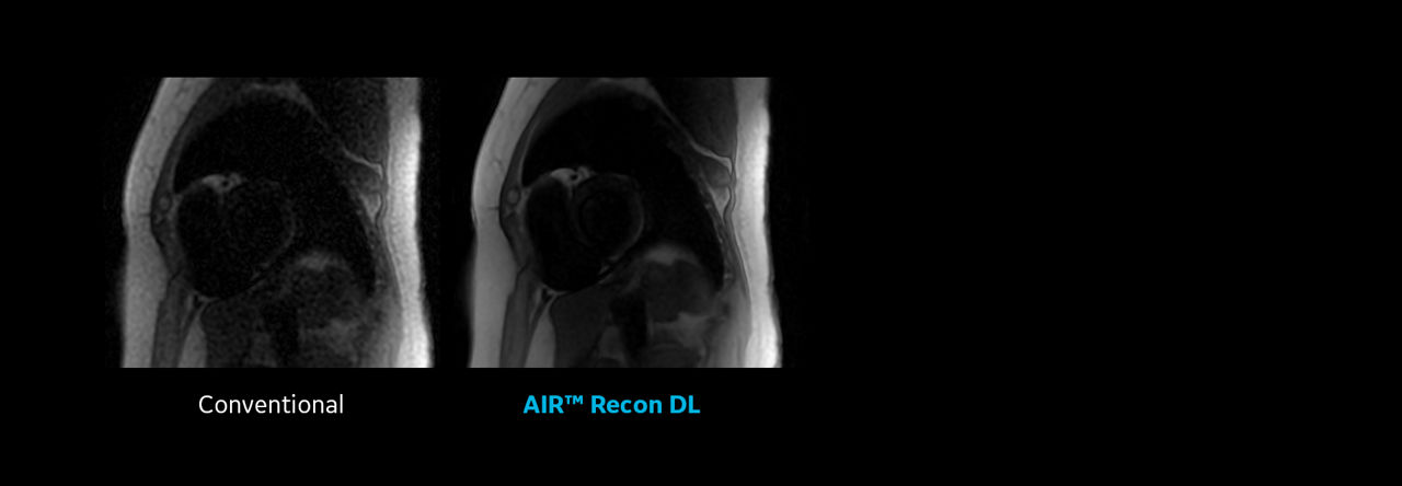 CVWorks_Product slider_AIR Recon DL_1920x665