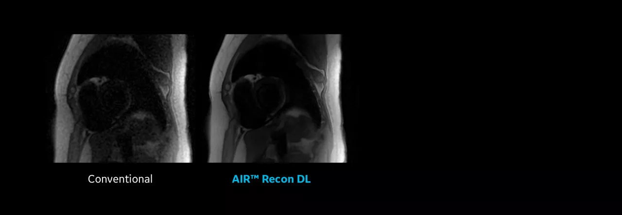 CVWorks_Product slider_AIR Recon DL_1920x665