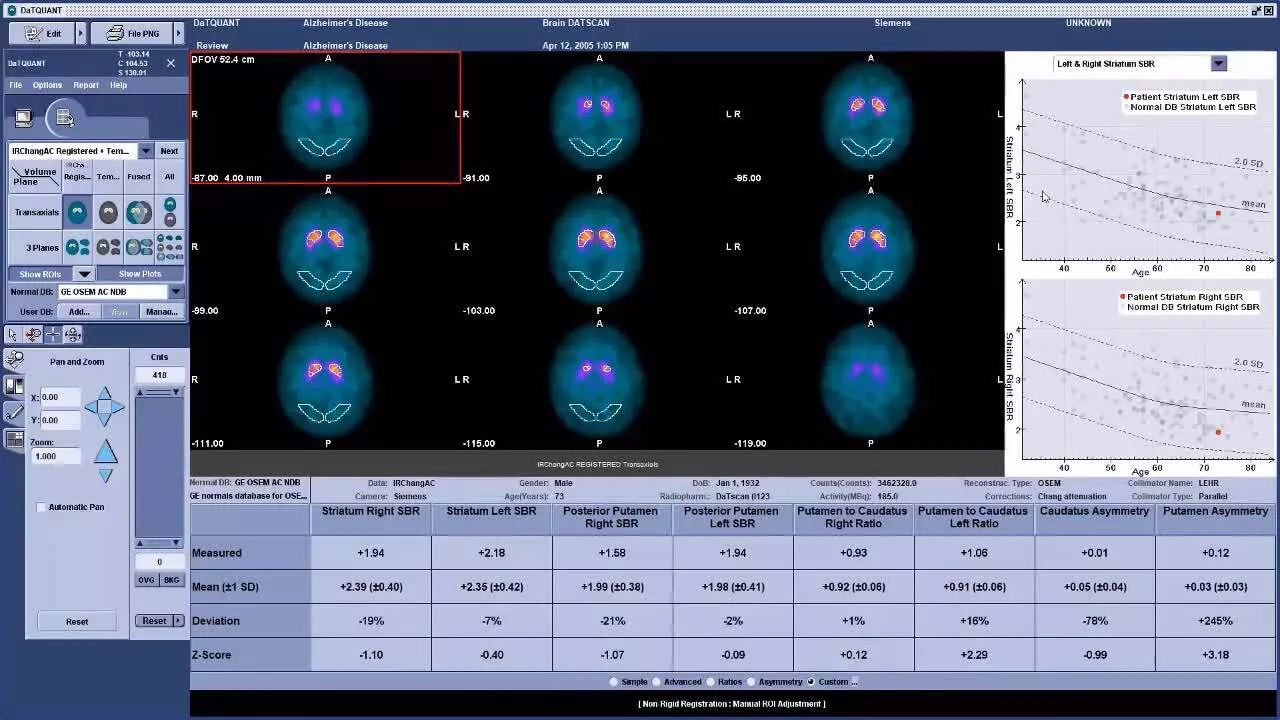 datquant-demo-video-jb01820uk-in-en