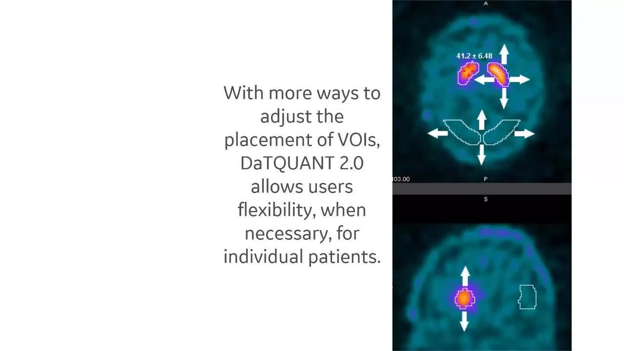 datquant-short-intro-video-jb01889uk-in-en