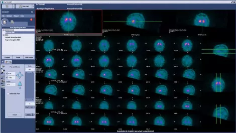 DaTQUANT-video-image-470px