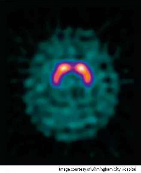 Normal Scan