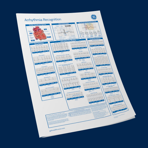 DCAR-Global-Arrhythmia Recognition  Part 1_LCS