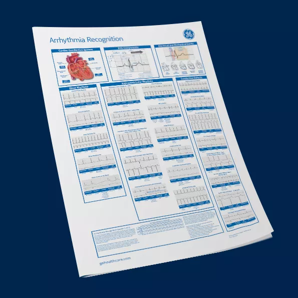 DCAR-Global-Arrhythmia Recognition  Part 1_LCS