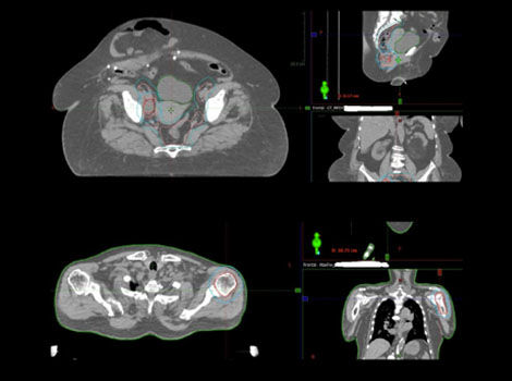 Deep-Learning-based-MaxFOV-2