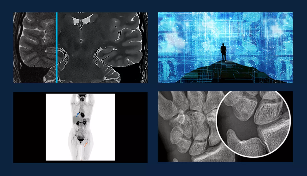 deep-learning-imaging-reconstruction