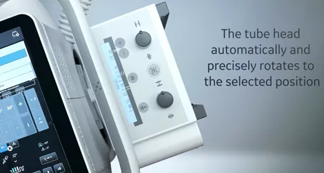 Definium Tempo-Auto Angulation