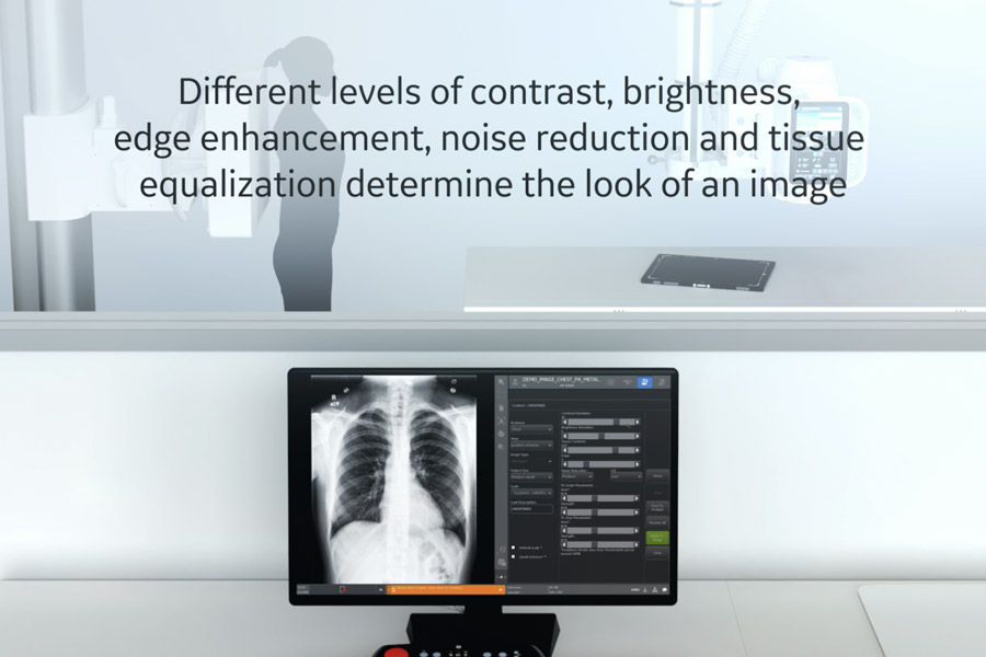 Definium-Tempo-IQ-Compare