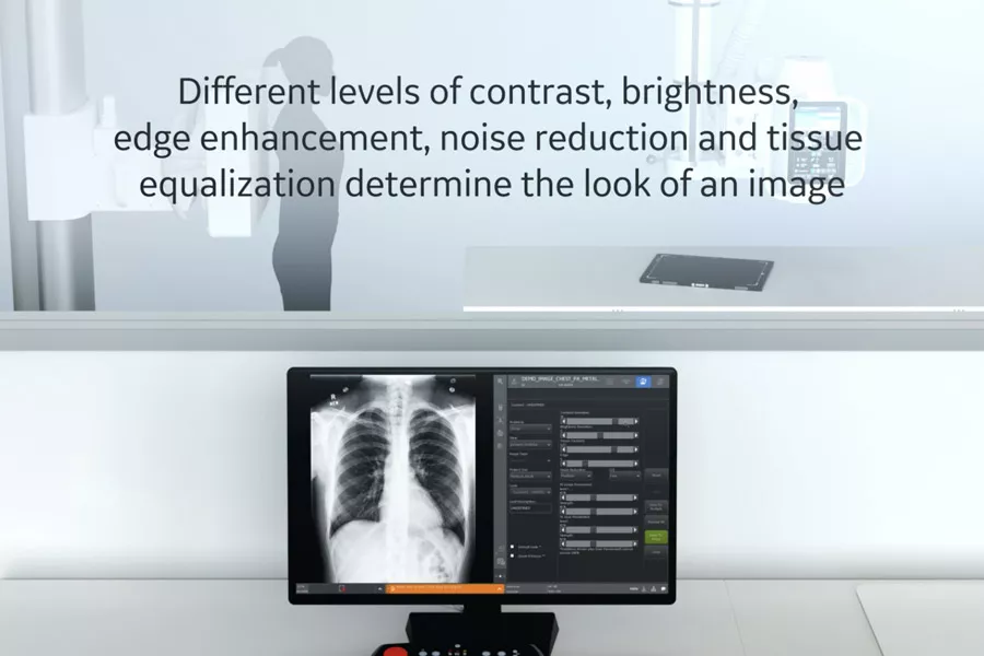 Definium-Tempo-IQ-Compare