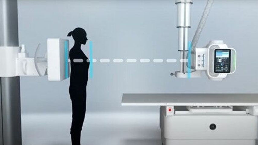 definium-tempo-technique-assist-feature-ci-en