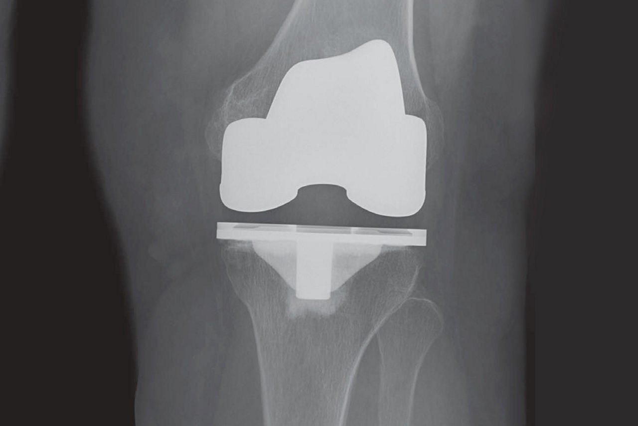 definium-xrf-knee-x-ray-ci-en