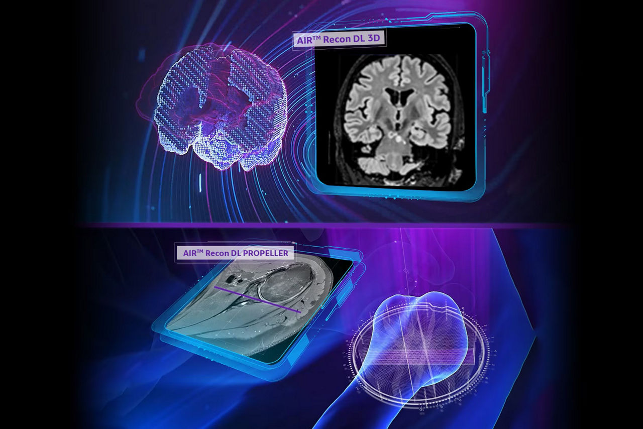 delivering-air-recon-dl-ci-en