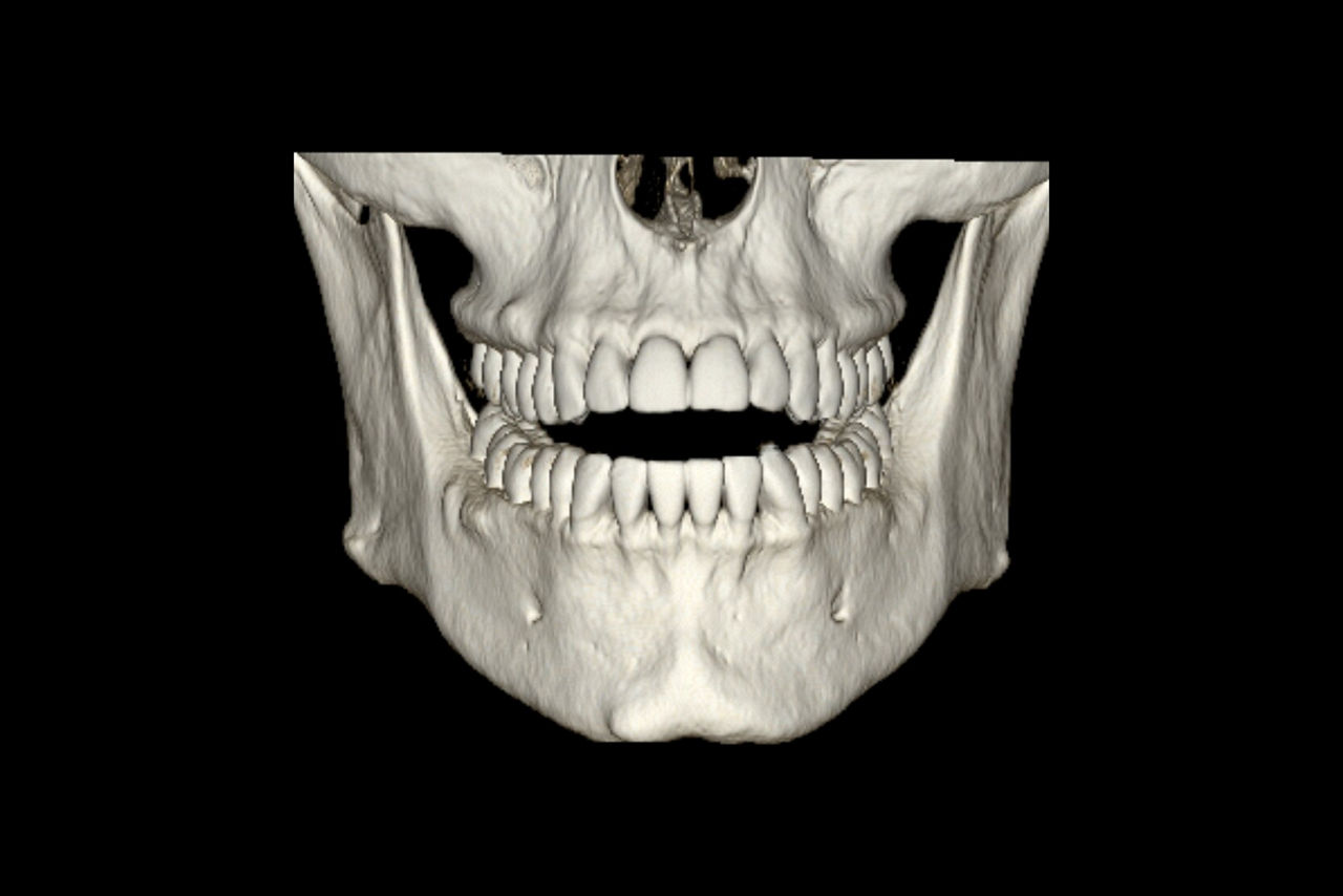 dentascan-features-hero-ci-en