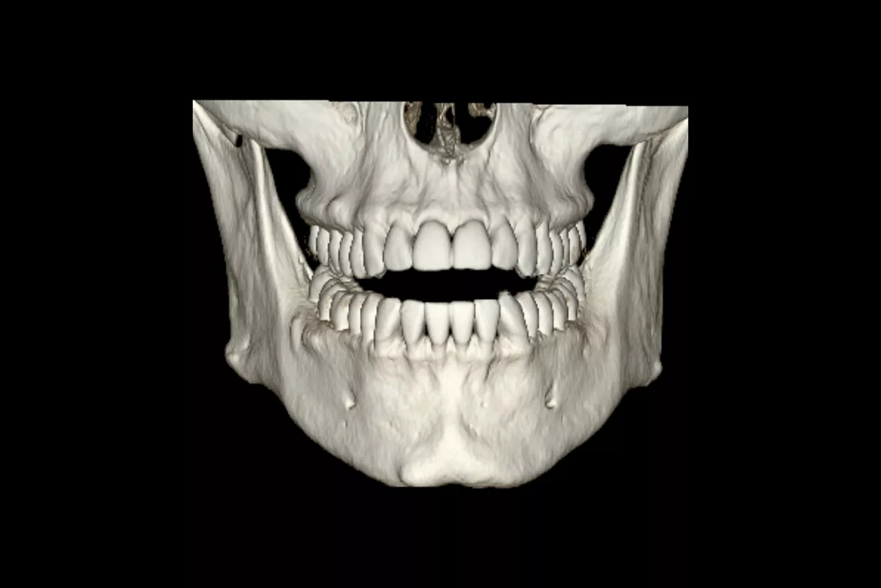 dentascan-features-hero-ci-en