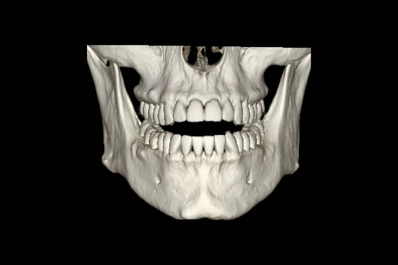 dentascan-features-hero-image