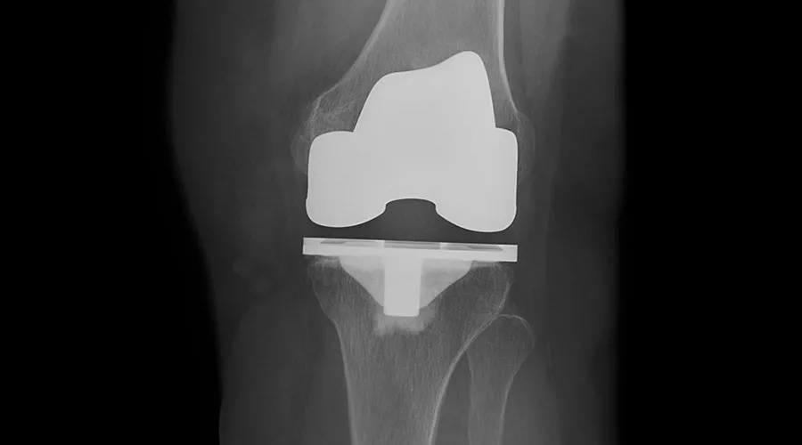 diagnostic-clarity-image6-900-500