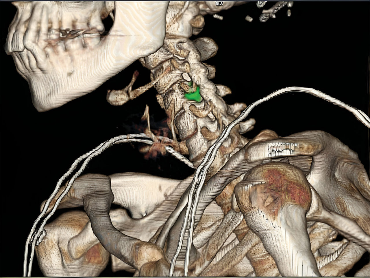 diagnostic-value-in-radiology-ArticleHero-ci-en