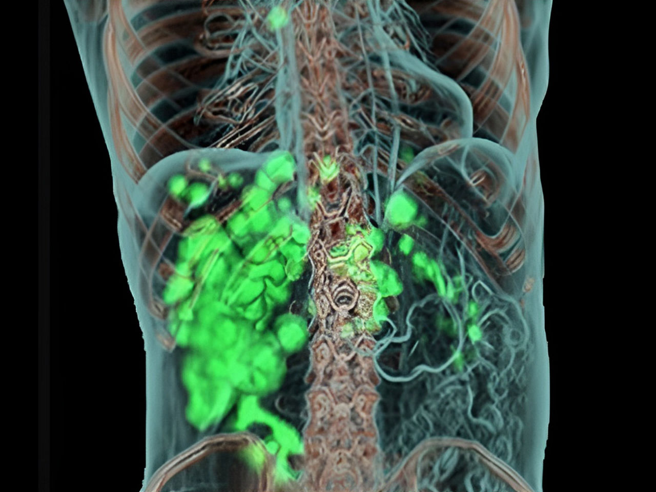 diagnostics-and-therapeutics-ArticleHero-ci-en