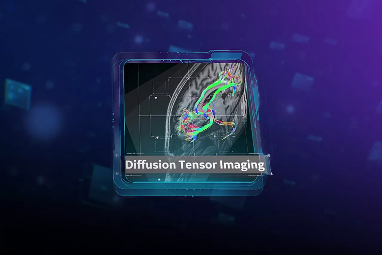 diffusion-tensor-imaging-ci-en