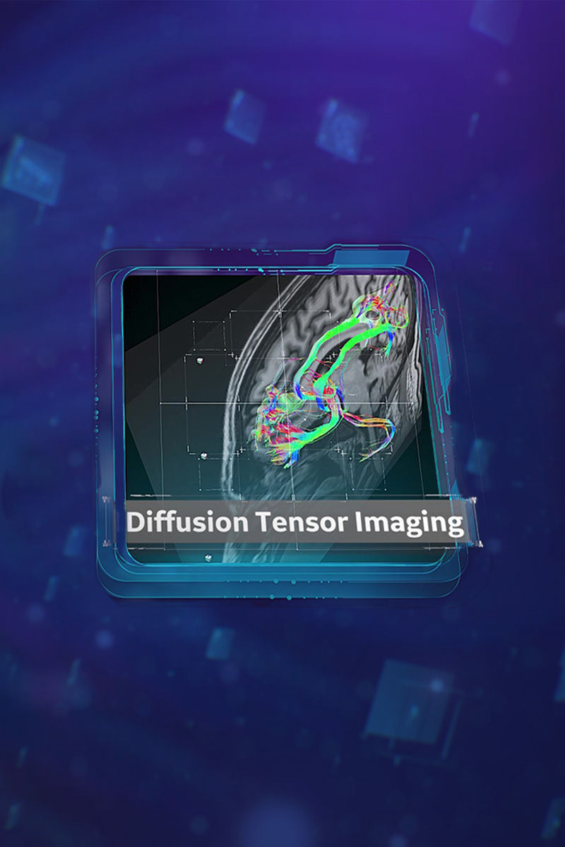 Diffusion Tensor Imaging for SIGNA MRI scanners 800x1200