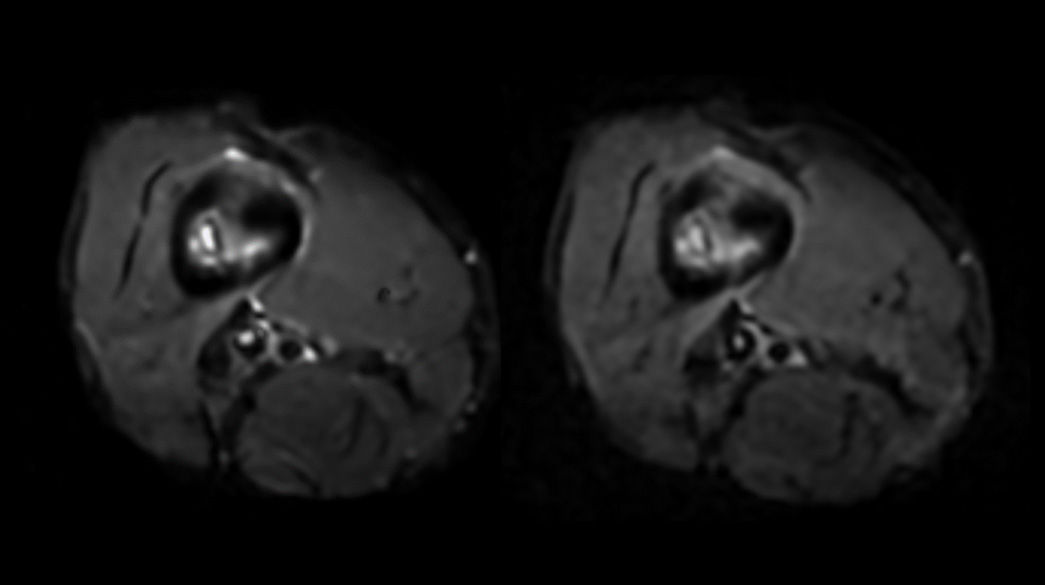 Diffusionand-Diffusion-Tensor-Imaging1040-x-585