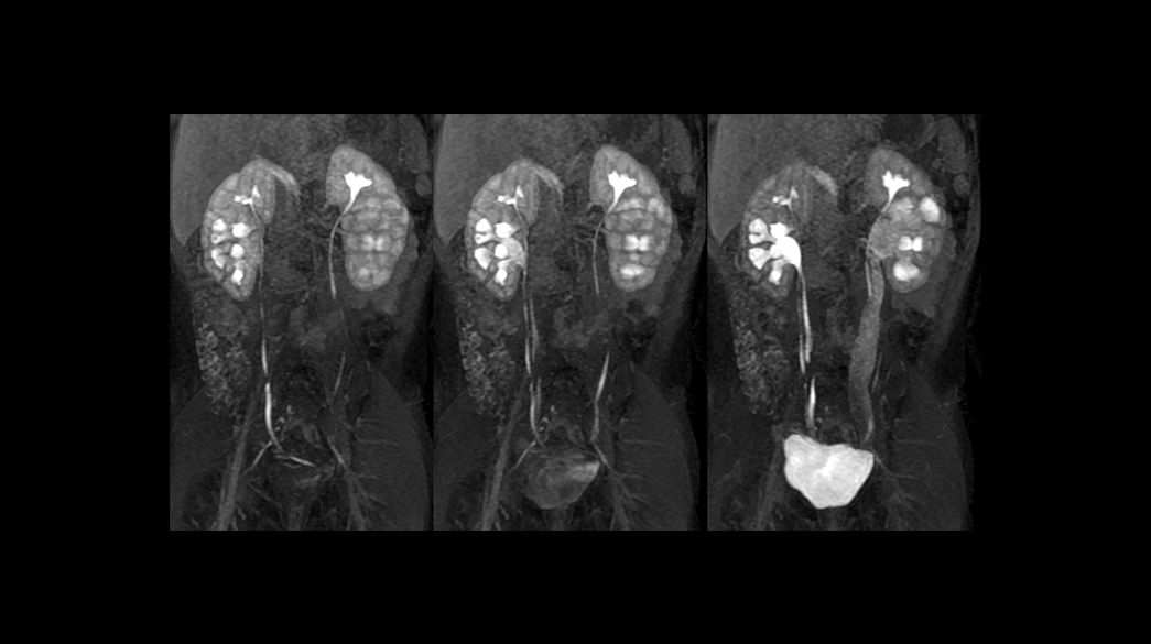 DISCO-and-DISCO-Flex1040-x-585