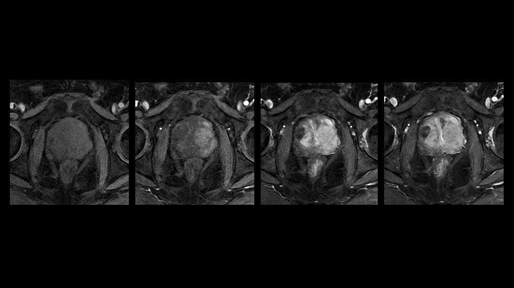 DISCOandDISCO-Flex1040-x-585