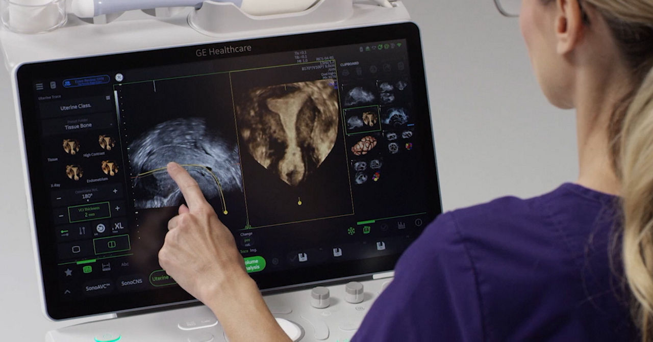 Discover Voluson Uterine Trace_Desktop