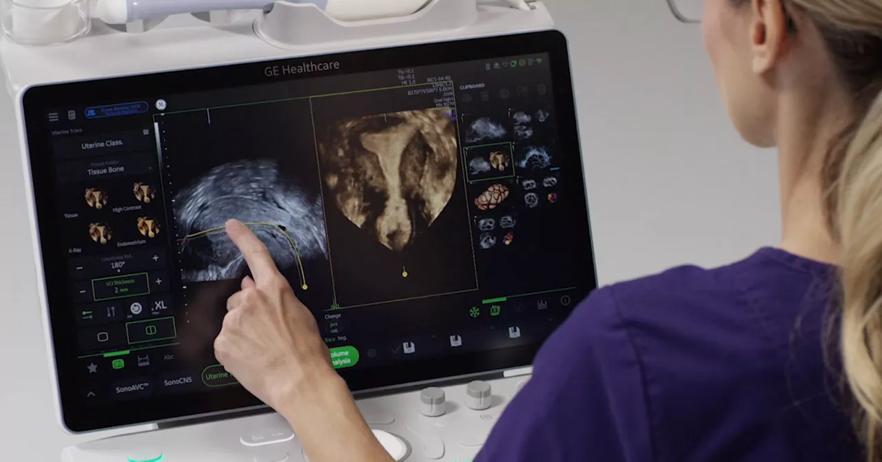 Discover Voluson Uterine Trace_Desktop