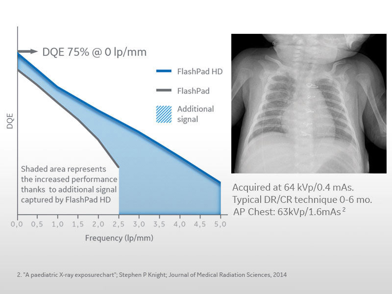 Discovery-656-G3-Exceptional-dose-efficiency