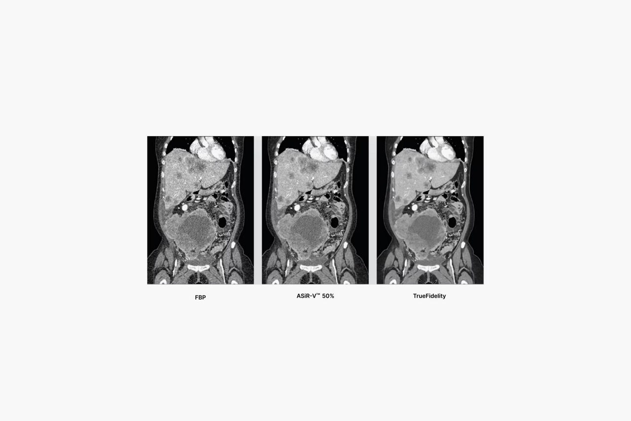 discovery-mi-gen-2-diagnostic-ct-ci-en