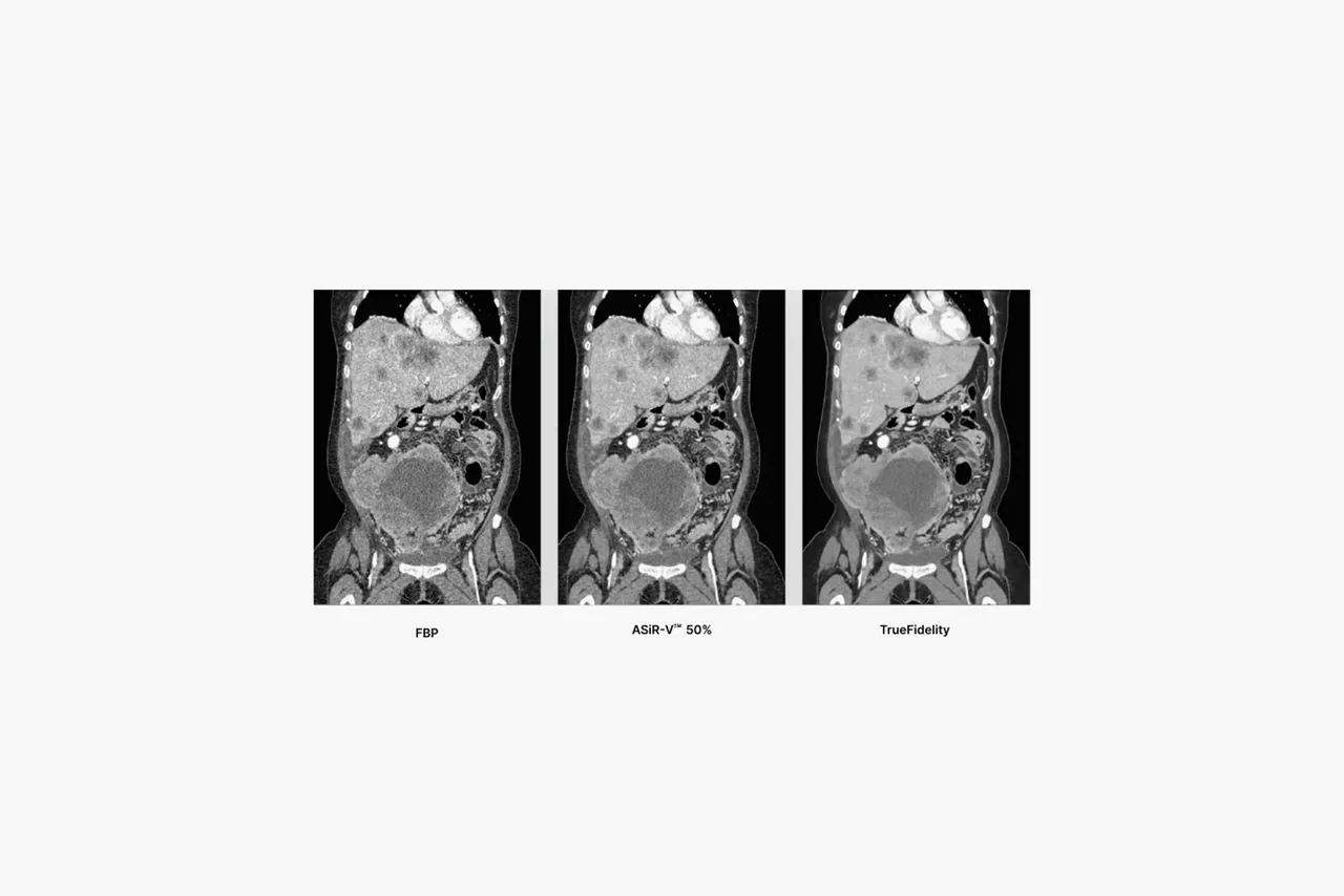 discovery-mi-gen-2-diagnostic-ct-ci-en
