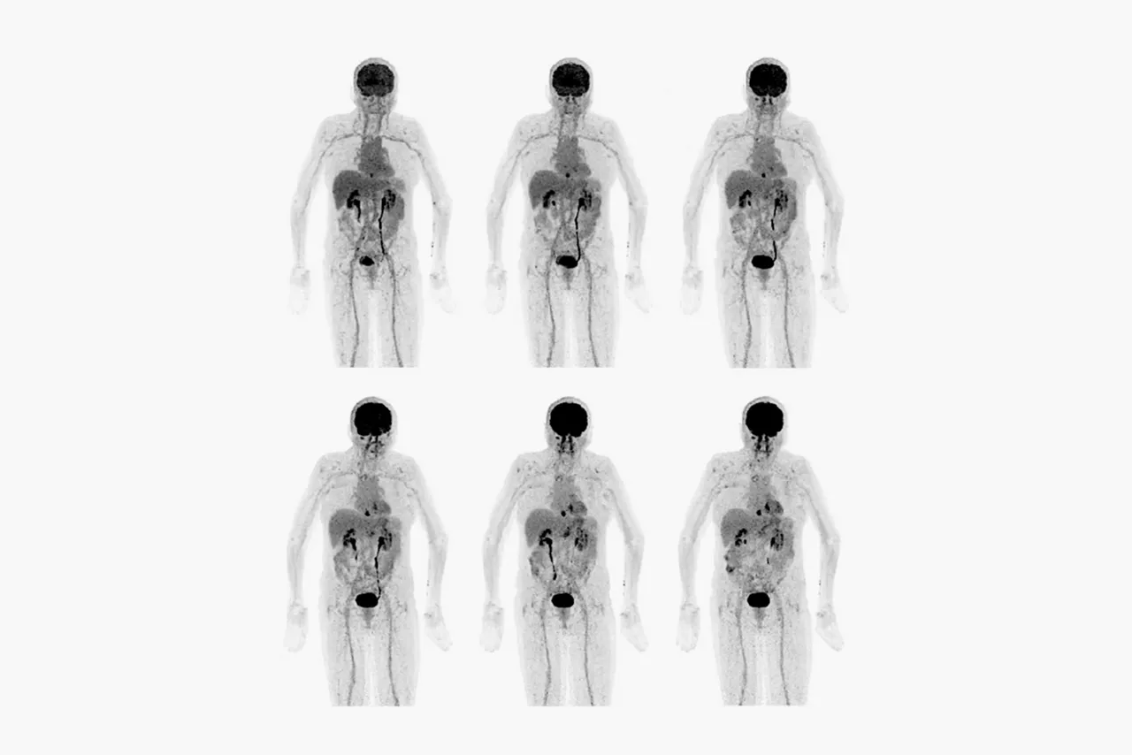 discovery-mi-gen-2-whole-body-iq-protocol-ci-en
