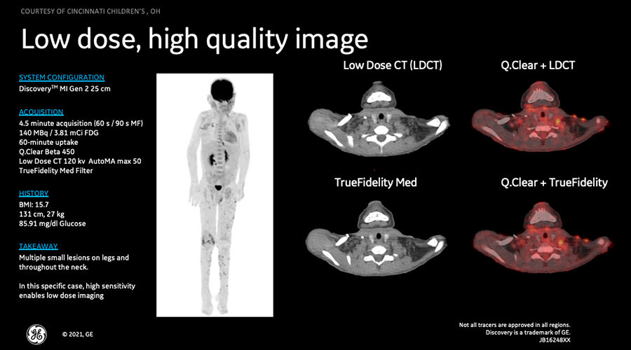 DMIG2 Updates Clinical Image 1
