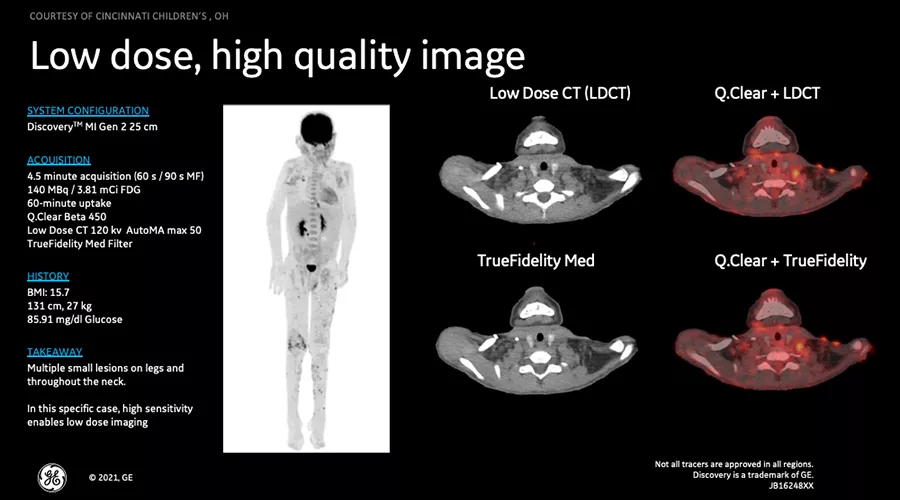 DMIG2 Updates Clinical Image 1