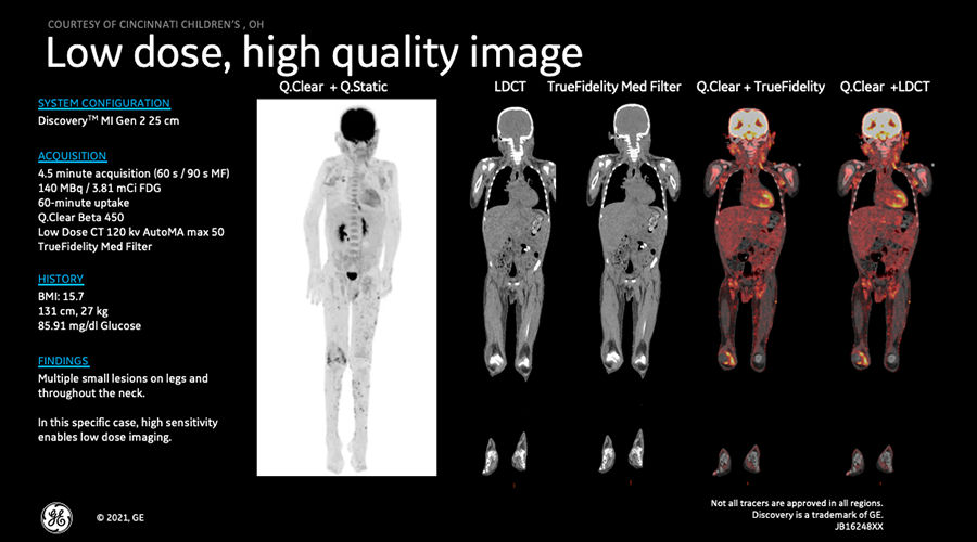 DMIG2 Updates Clinical Image 2