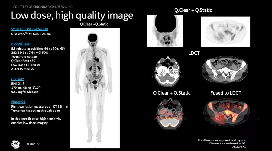 DMIG2 Updates Clinical Image 3