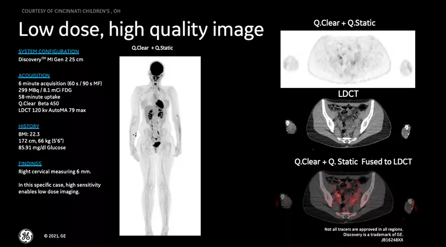 DMIG2 Updates Clinical Image 4